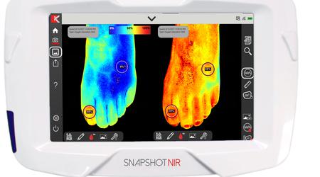 Bärbar diagnostisk enhet "Snapshot NIR" ska ersätta ultraljud och röntgen