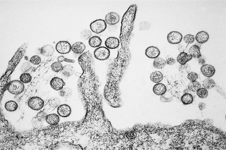 Australiensiskt laboratorium missar farliga virus på ...