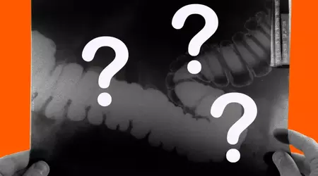 Läkare som använde AI-utrustning förlorar sina kvalifikationer