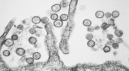 Australiensiskt laboratorium missar farliga virus på grund av frysfel