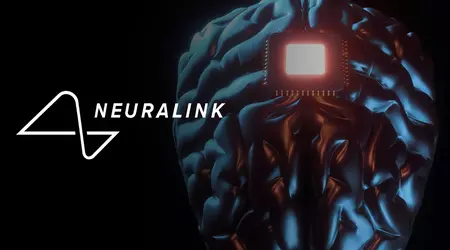 Expansion av Neuralink-programmet: volontärer från hela världen kan nu ansöka om implantation av den innovativa neurochipen