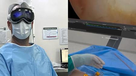 Apple Vision Pro hjälper läkare i Brasilien: Innovativt headset används vid artroskopi av axlar