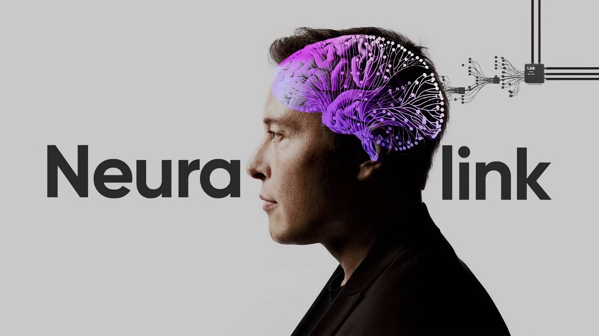 Elon Musk: Neuralink har implanterat det första implantatet i en mänsklig hjärna
