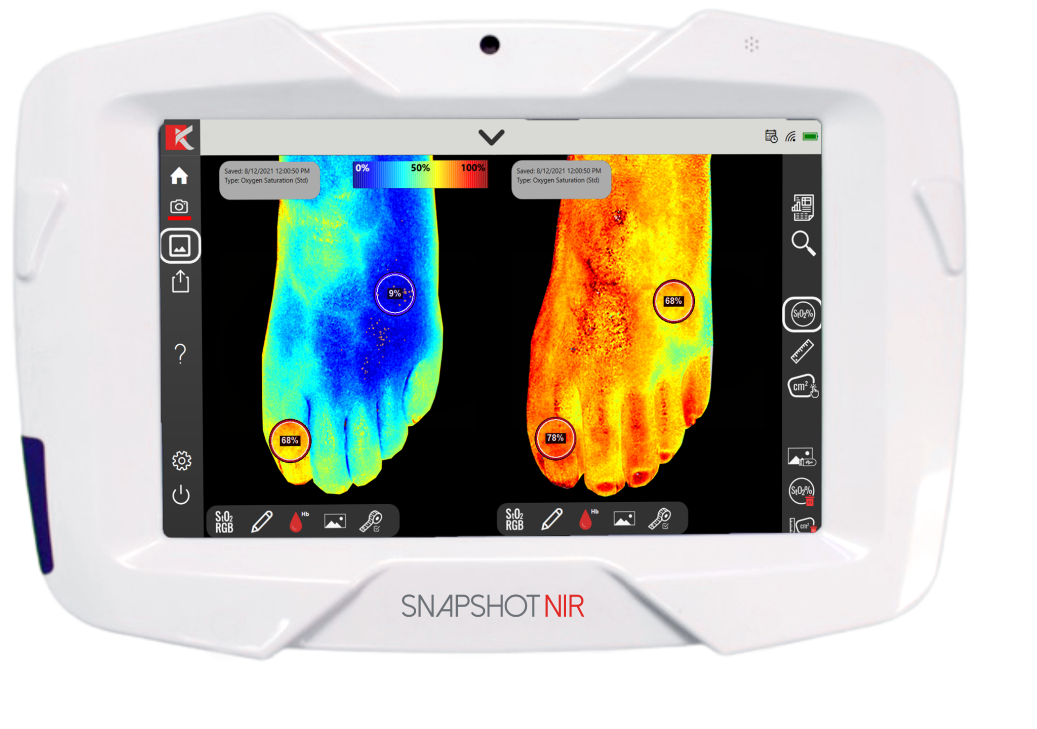 Bärbar diagnostisk enhet "Snapshot NIR" ska ersätta ultraljud och röntgen