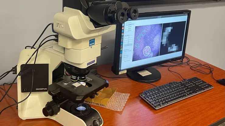 Google och Pentagon har utvecklat ett mikroskop baserat på artificiell intelligens för cancerdiagnos-2